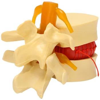 Модел на лумбалните прешлени Анатомичен гръбначен стълб Лумбална дискова херния Анатомия Инструмент за обучение Лумбални прешлени Модел